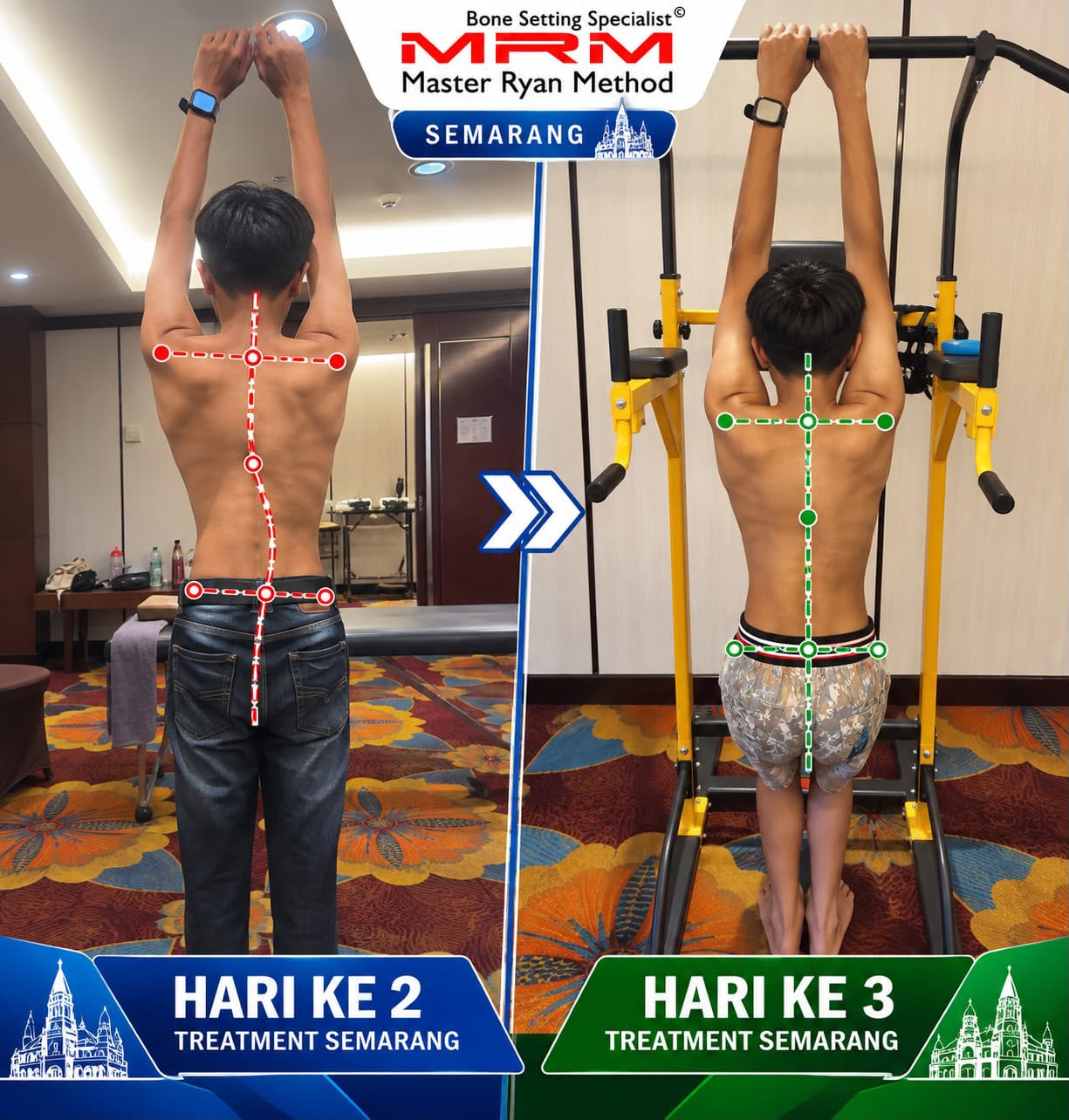 Hasil treatment hari ke-2 dan hari ke-3 - MRM Semarang